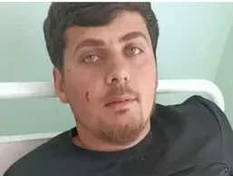 Azerbaijani Survivor of Drone Attack Speaks Out – VIDEO